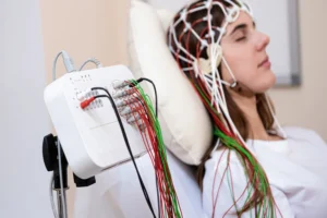 TMS Therapy