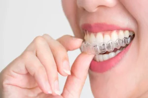 Right Orthodontist In Chantilly