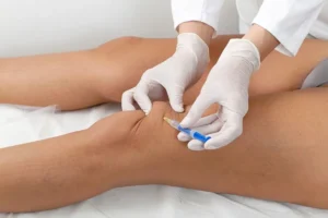 Hyaluronic Acid