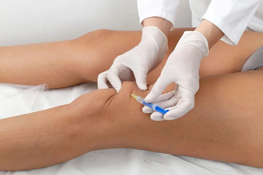 Hyaluronic Acid