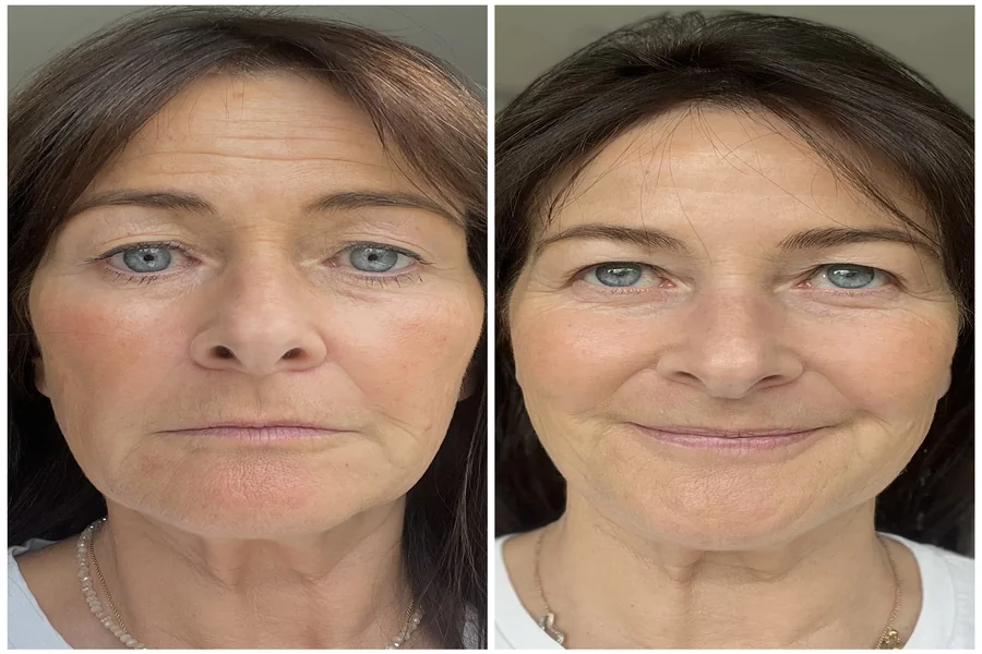 Skincare Technologies