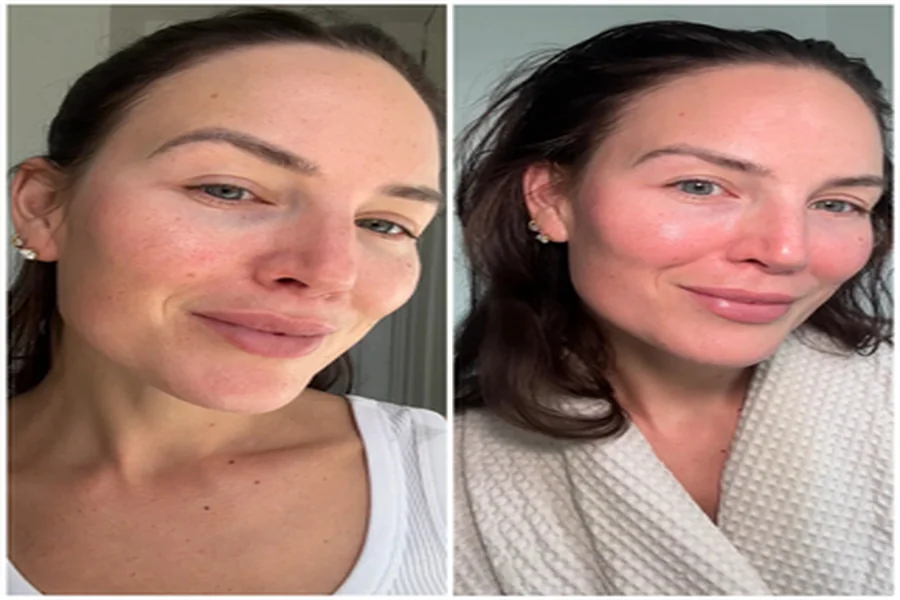 Skincare Technologies