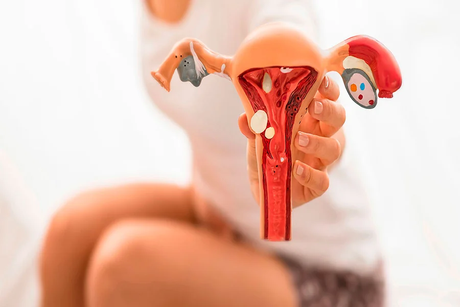 Fibroid Sizes